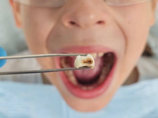 Best Dentist for Severe Toothache  in Akron, OH